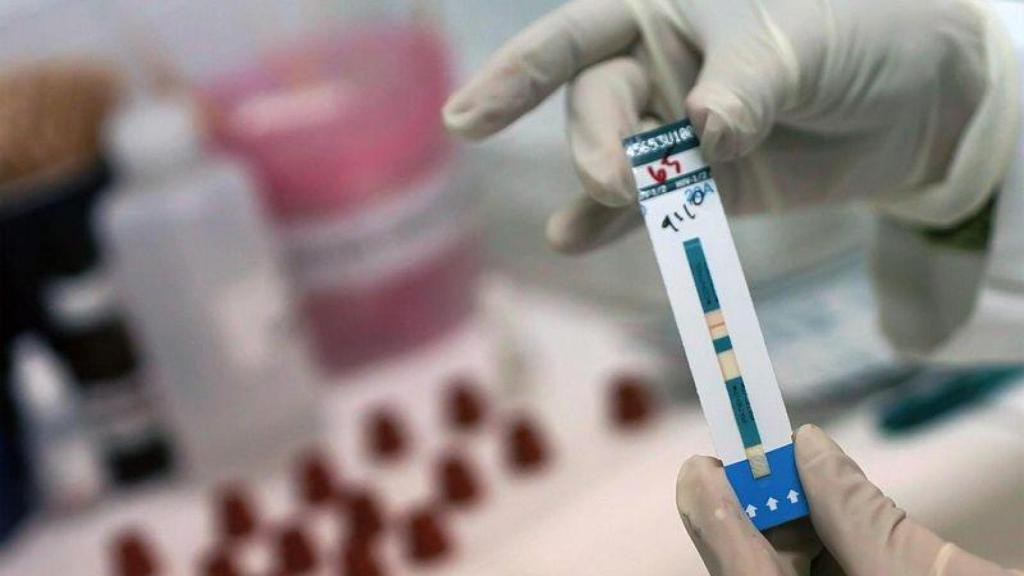Las pruebas del VIH se podrán comprar en farmacias sin receta