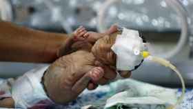 Un bebé prematuro en un hospital de Sanaa. En Yemen un 30% de los recién nacidos son prematuros
