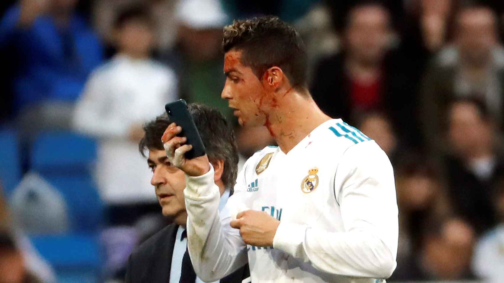 Ronaldo observa su herida en el móvil del médico del Real Madrid.