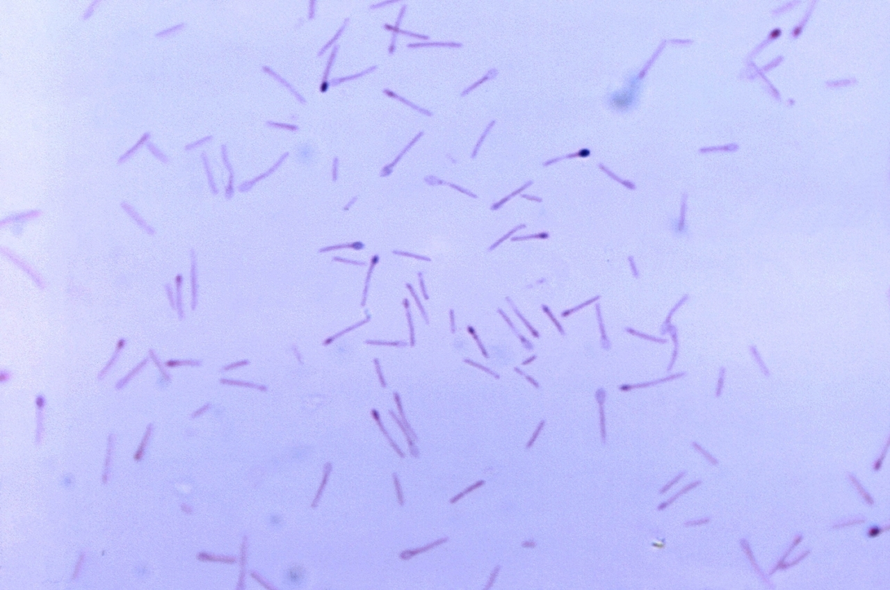 Clostridium is a genus of anaerobic spore forming bacteria in th