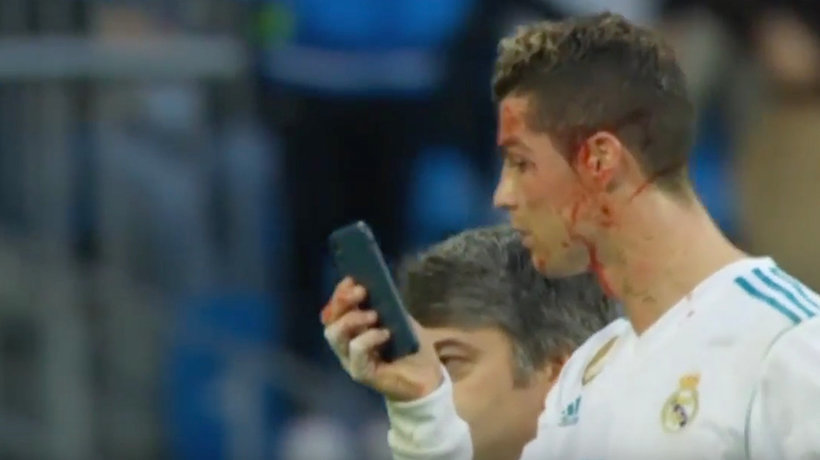 Cristiano Ronaldo viéndose la herida