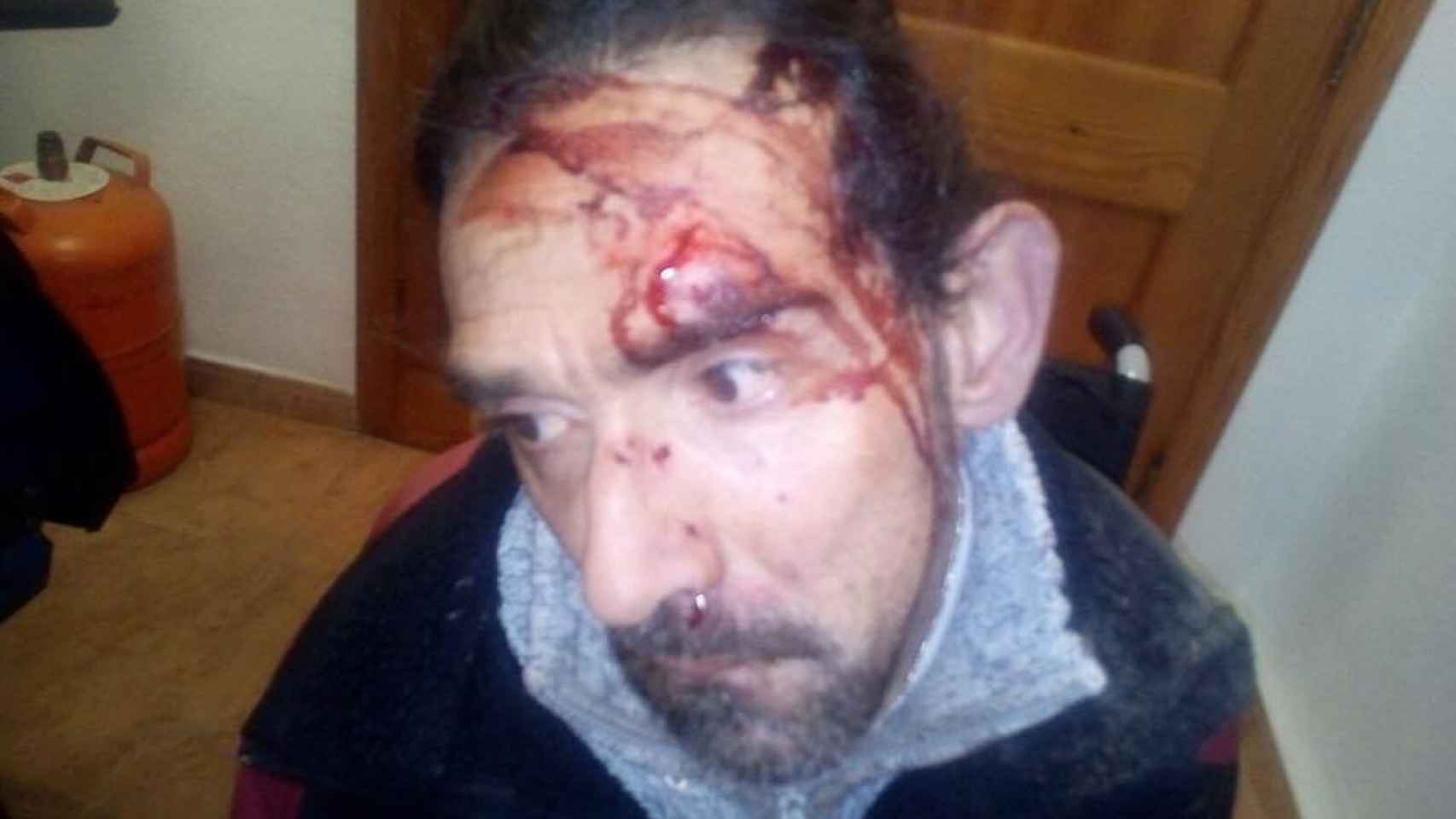 El valenciano Enrique Marí, de 43 años, recibió una paliza por parte de dos hombres el pasado sábado.