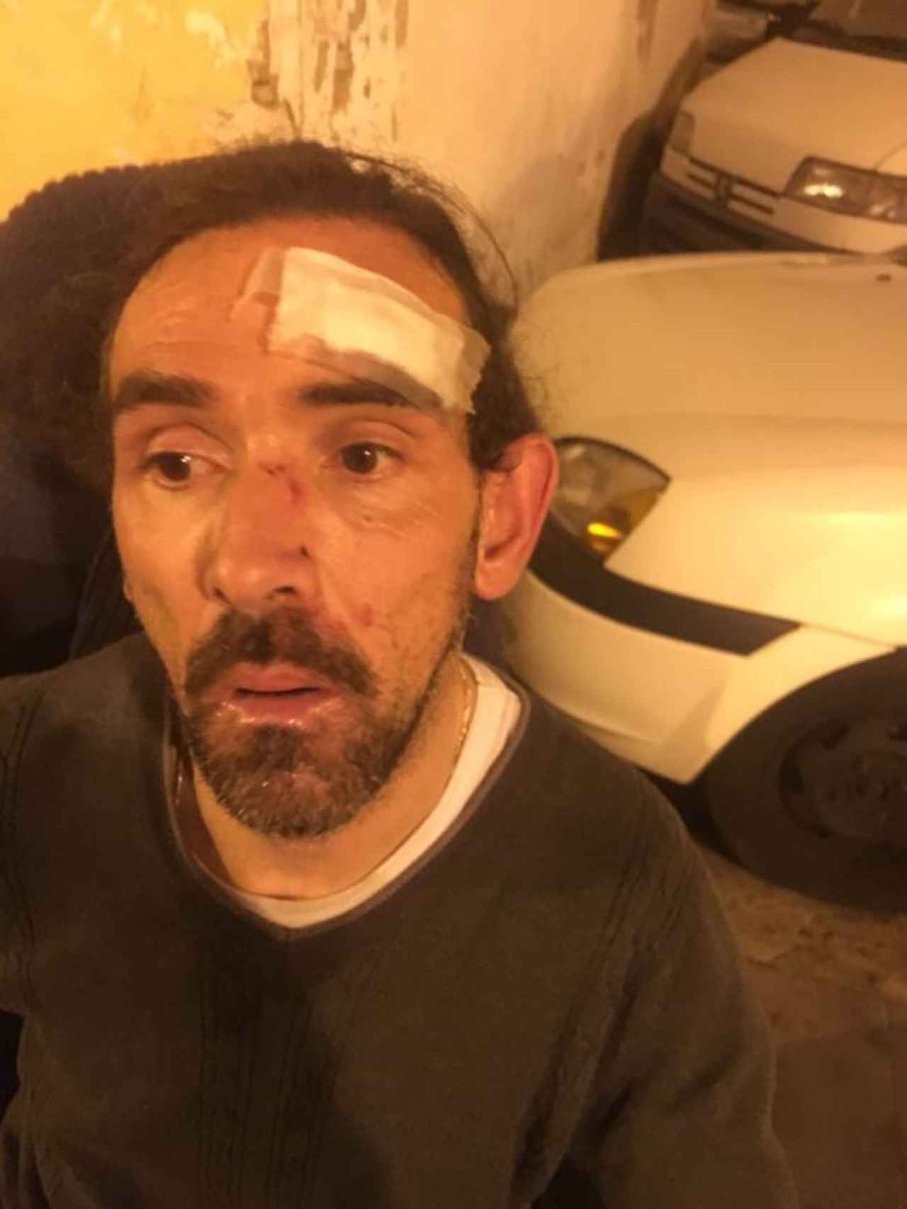 Enrique Marí, victima de la agresión, tras recibir atención médica en el Hospital Clínico de Valencia.