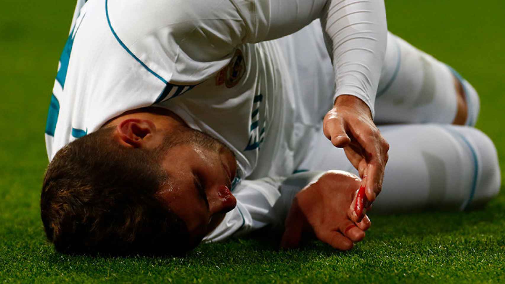 Theo Hernández sangrando tras un duro golpe Foto: Pedro Rodríguez/El Bernabéu