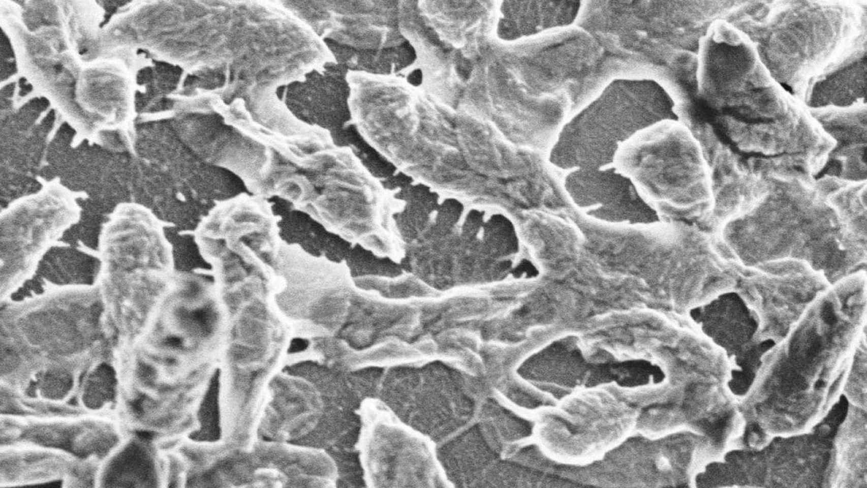 Imagen al microscopio de la bacteria Aeromonas hydrophila strain SSU, responsable del incidente.