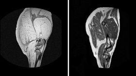 Imágenes de un jamón fresco (izqda) y curado (drcha) obtenidas con tecnología MRI. / TECAL-GIM