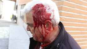 Agricultor herido a las puertas de las Cortes. Foto: Ó. Huertas