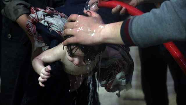 Un niño afectado por el ataque químico es tratado en un hospital de Duma.