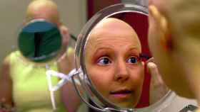 Una mujer calva por la quimioterapia.