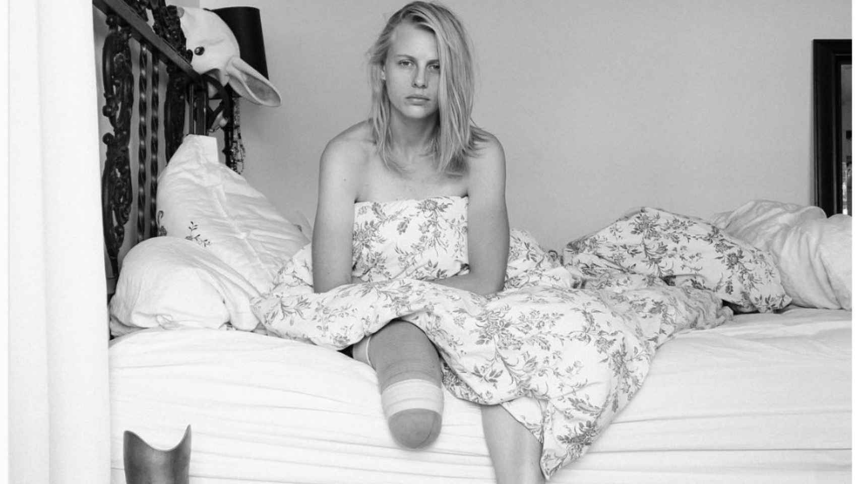 La modelo Lauren Wasser perdió una pierna después de sufrir síndrome de shock tóxico por un tampón.