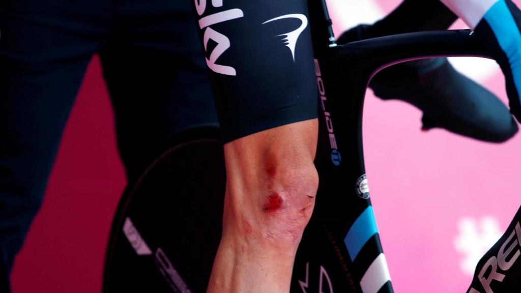 Las heridas de Froome tras caerse antes del prólogo.