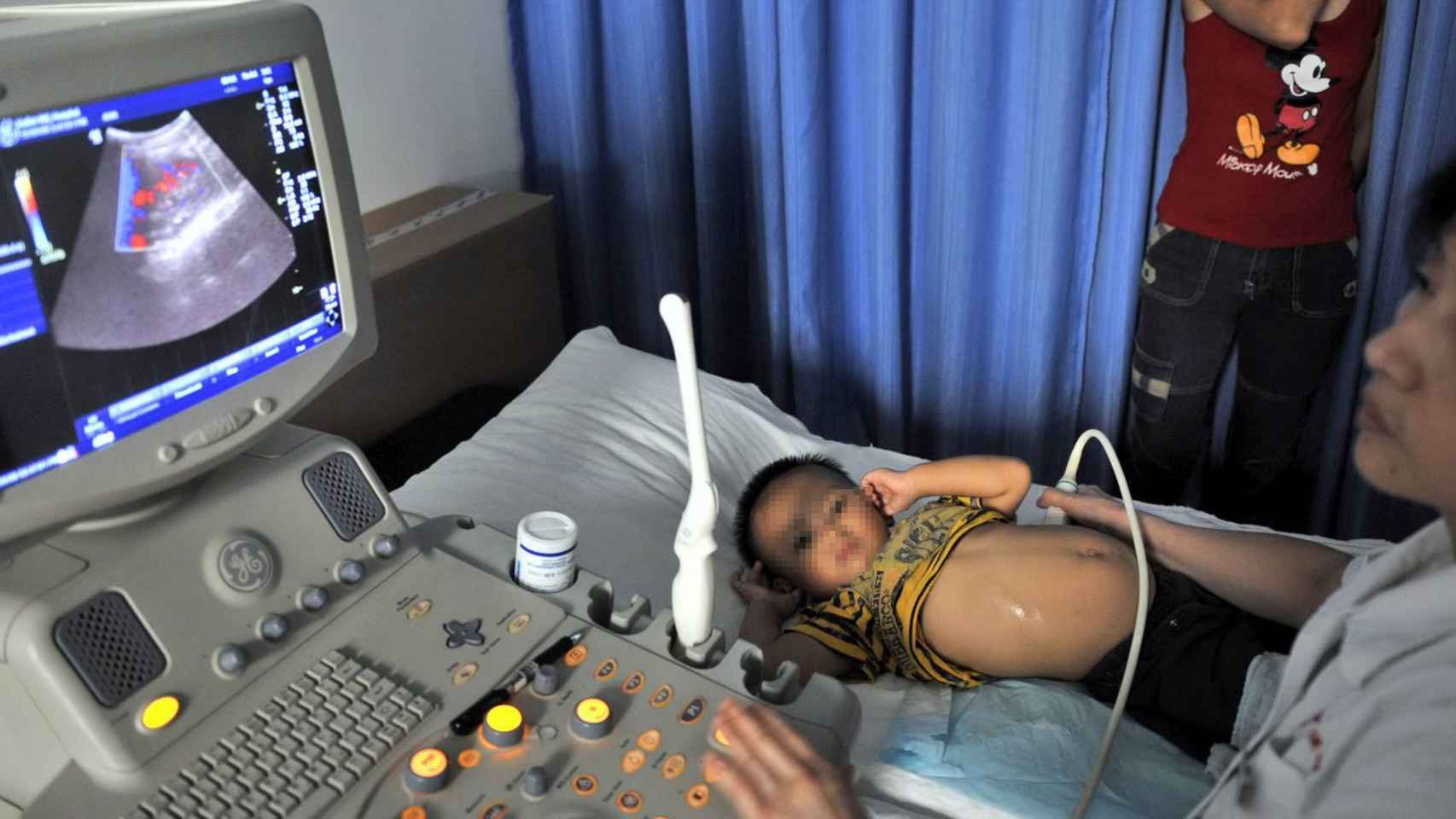 Un niño pequeño tratado de piedras del riñón en un hospital de Wuhan, China.