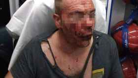 Heridas sufridas por el agente que fue agredido en Córdoba cuando estaba fuera de servicio.