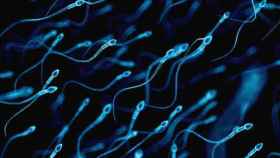 Un grupo de espermatozoides se mueven a su libre albedrío.