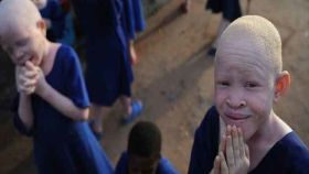 Las personas albinas en África son víctimas de agresiones y asesinatos.