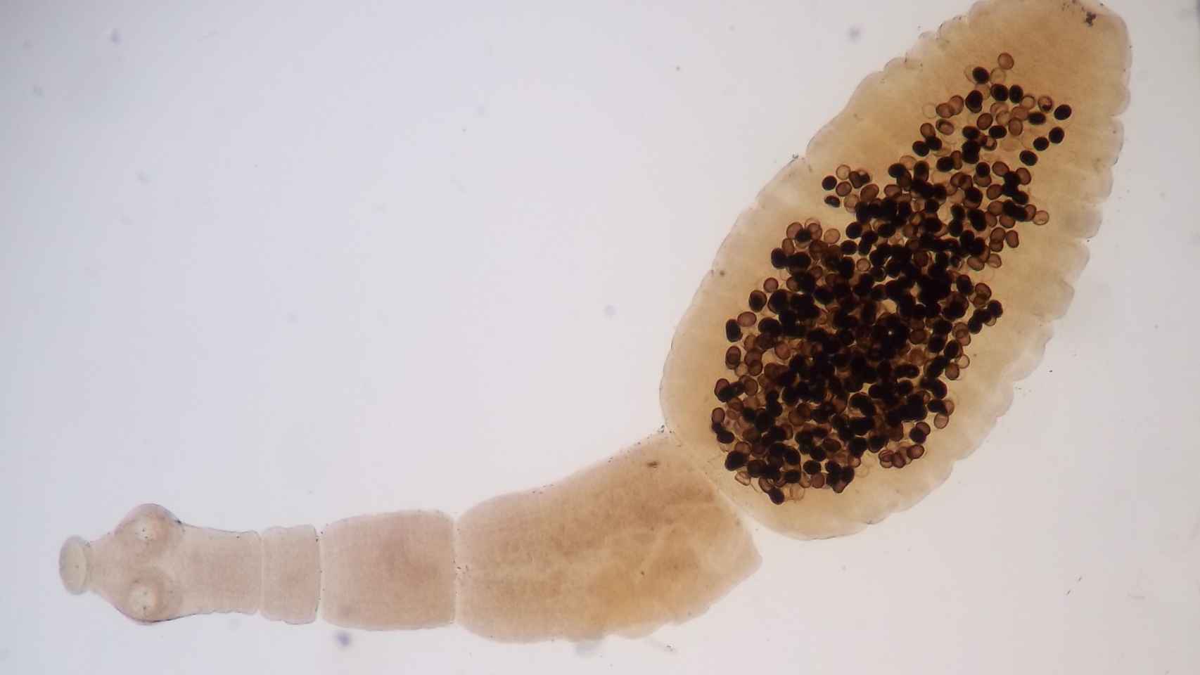 El Echinococcus granulosus causante de la dolencia