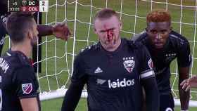 Wayne Rooney, con la nariz rota en un DC United - Colorado Rapids. Foto: mlssoccer.com