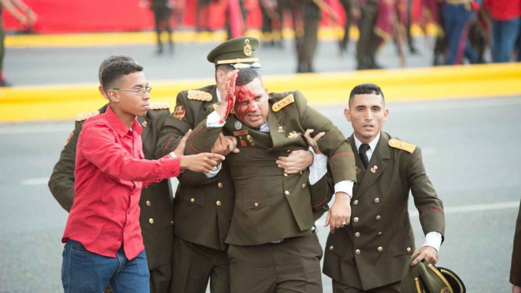 Un militar herido tras el atentado contra Maduro, en Caracas.