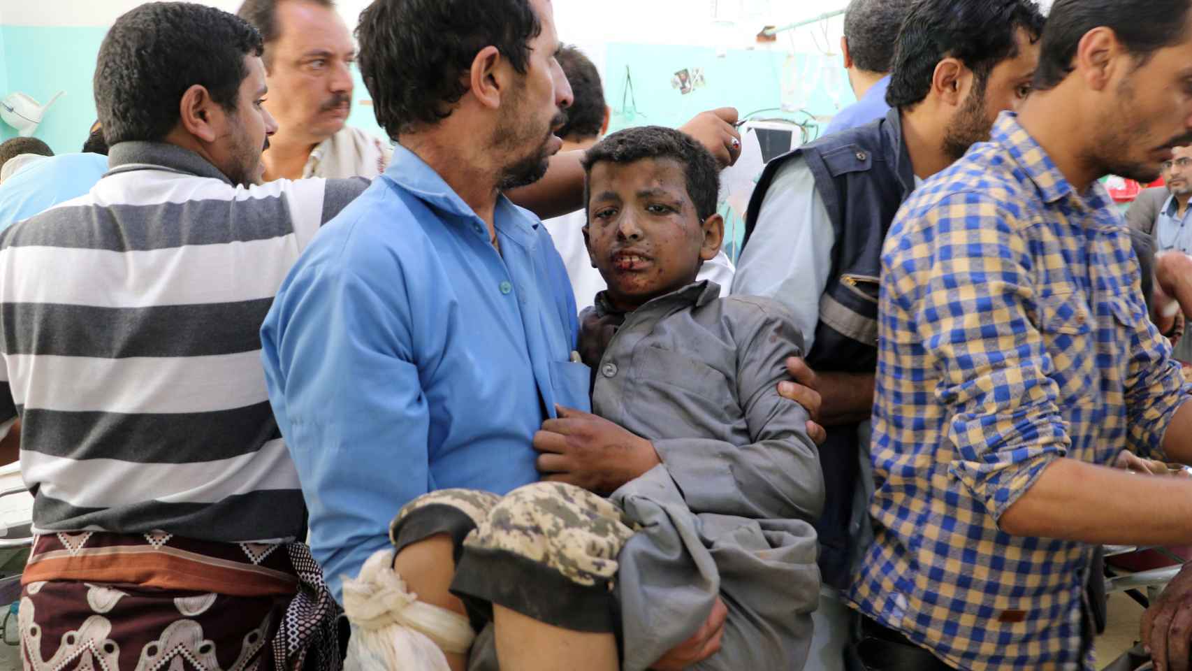 Un hombre sostiene a un niño que resultó herido por un ataque aéreo en Yemen.