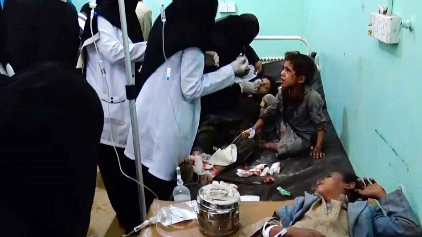 Varios niños yemeníes heridos mientras reciben atención médica tras un ataque aéreo.