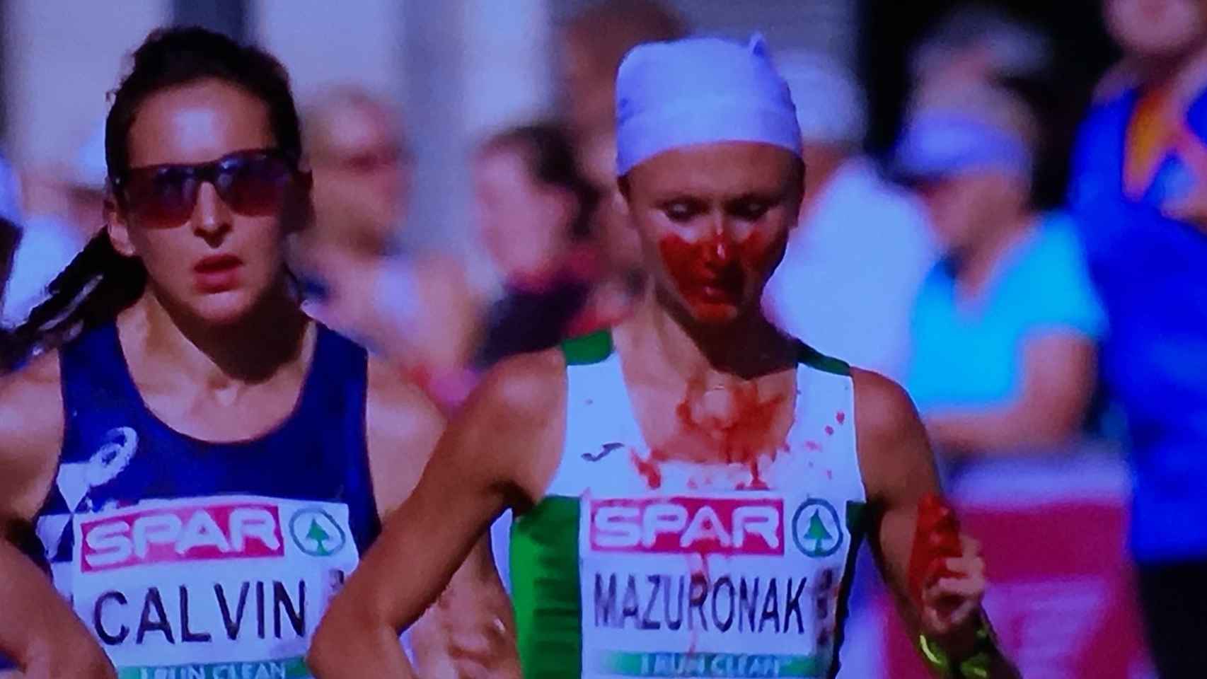 Mazuronak sangrando durante la maratón en Berlín