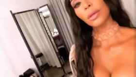 Kim Kardashian luciendo uno de los collares implantados en la piel.
