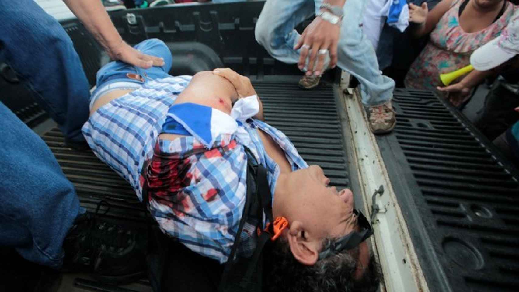 Hombre herido en el tiroteo de la manifestación contra Ortega en Managua.