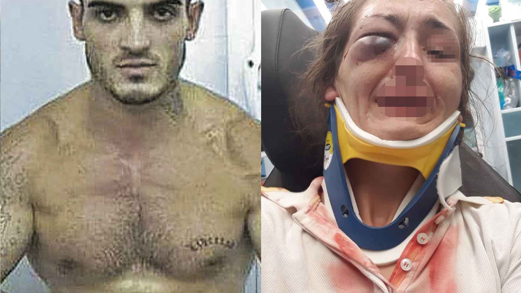 La brutal paliza que el boxeador Arnau propinó a su novia de Mallorca “Casi me mata” imagen