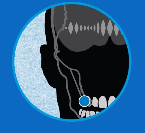 Micrófono dental