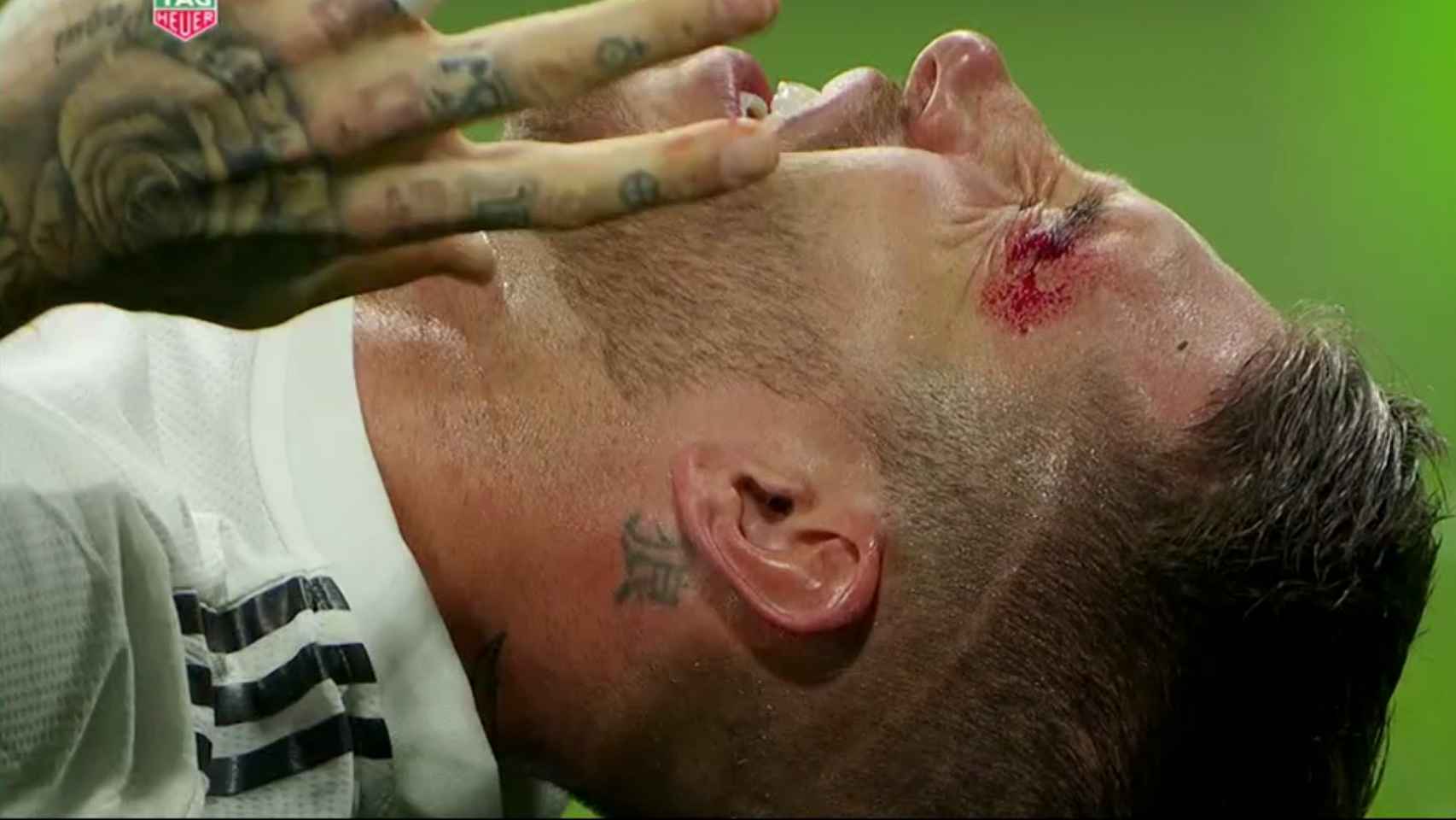 Sergio Ramos, herido en la ceja
