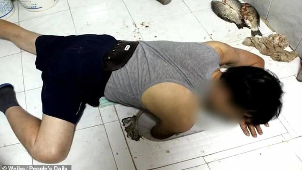 Los rescatistas tuvieron que romper por completo el WC para salvarle el brazo a este hombre