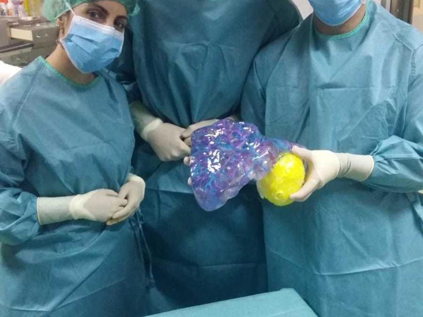 Los médicos con el modelo en resina del hígado.