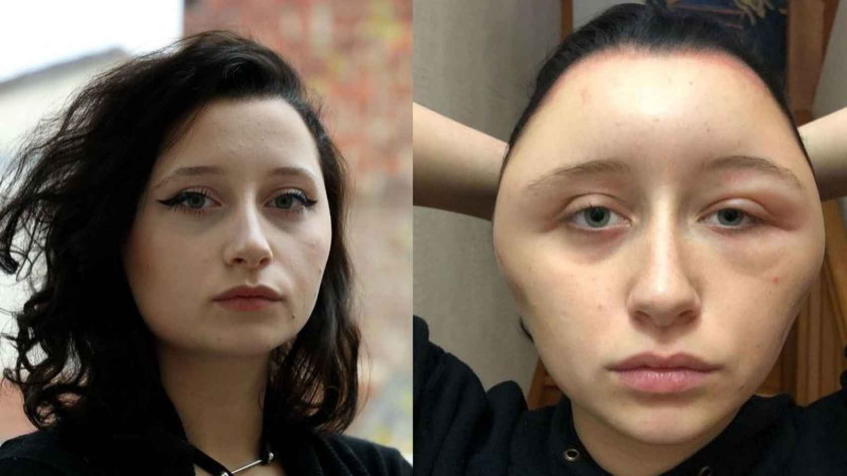 El antes y el después de la pobre Estelle
