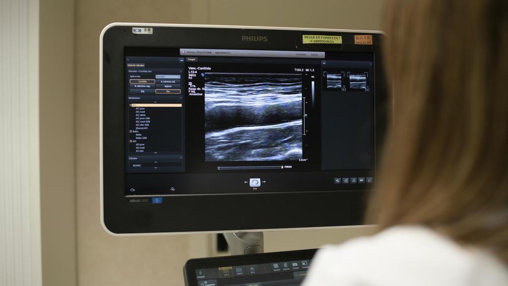 Ecografía 3D: un sistema pionero para identificar el riesgo cardiovascular