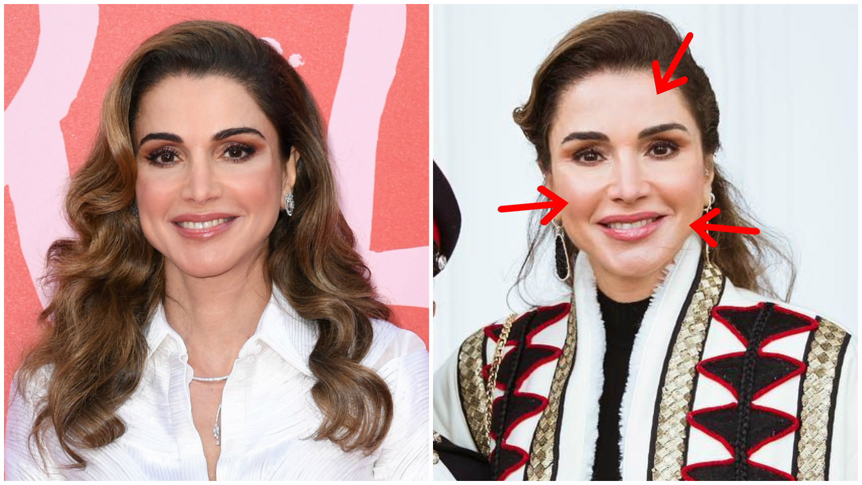 Rania de Jordania en una imagen de hace un año (izquierda) y en una imagen reciente (derecha).