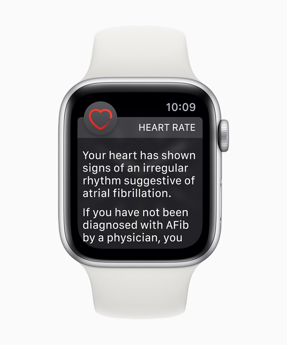 Los Apple Watch 4 activan los electrocardiogramas en su ltima