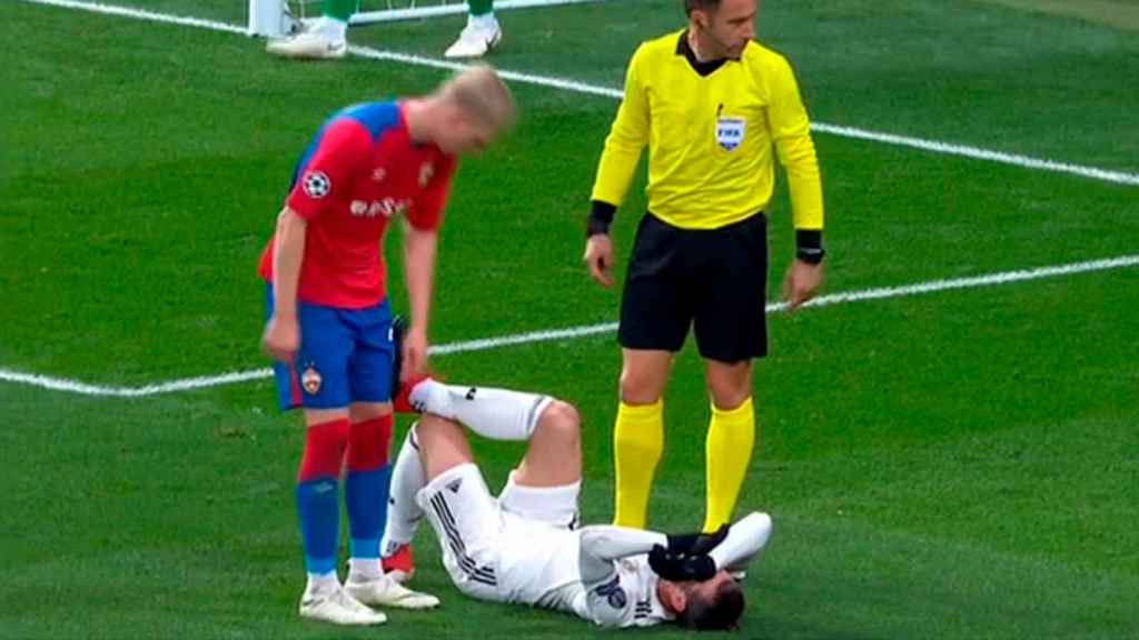 Gareth Bale se lesiona frente al CSKA de Moscú