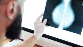 Investigadores de Girona aíslan células madre de cáncer de mama con impresión 3D