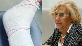 Manuela Carmena, atendida en el hospital de la Princesa por una lesión de tobillo