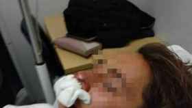 Imagen del menor supuestamente apaleado por cinco policías en Melilla.