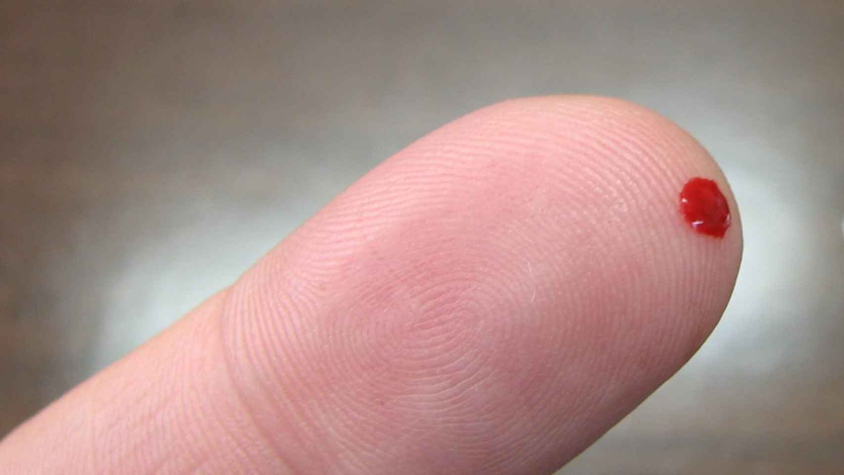 Pinchazo en el dedo de un diabético para medir el azucar en sangre.