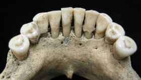 Image: Los dientes azules de la primera artista de ilustraciones medievales
