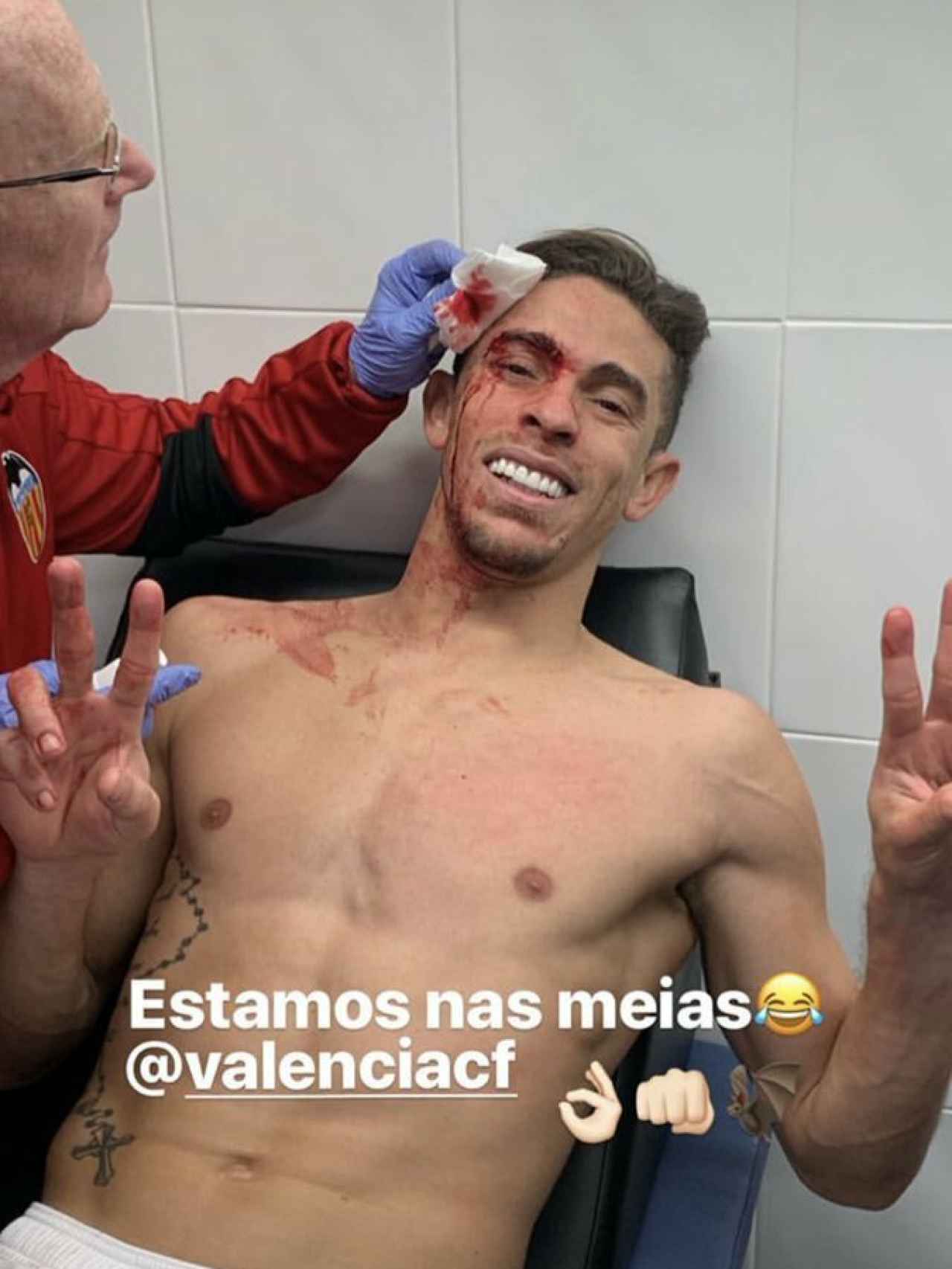Gabriel Paulista tratándose tras el duro golpe. Foto: Instagram. (@goncaloguedes15)