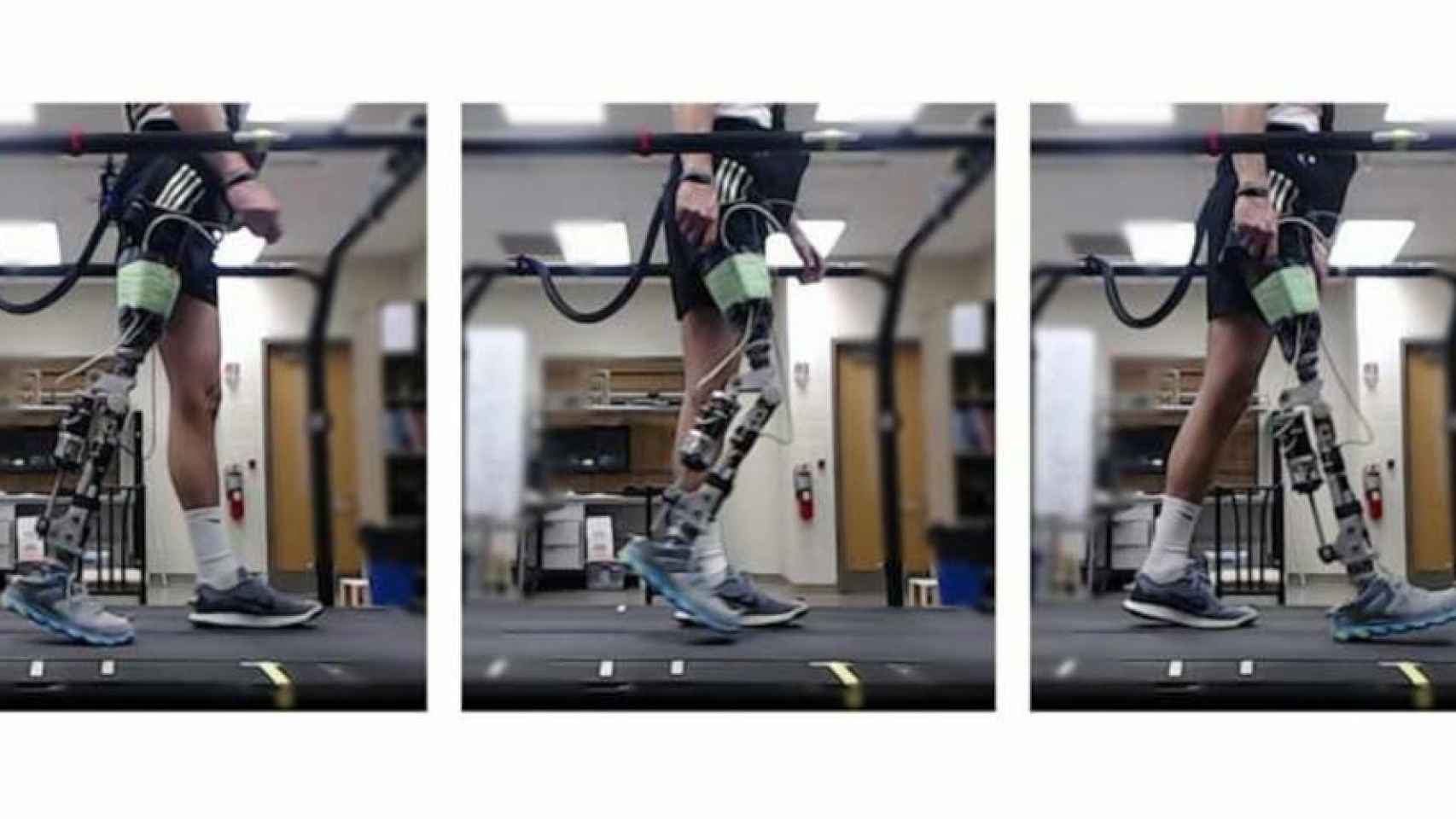 Prótesis robótica