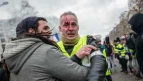 Un herido se enfrenta a la Policía en las calles de París durante las protestas de los 'chalecos amarillos'.