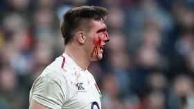 Tom Curry sangra por la cabeza en el Inglaterra - Francia