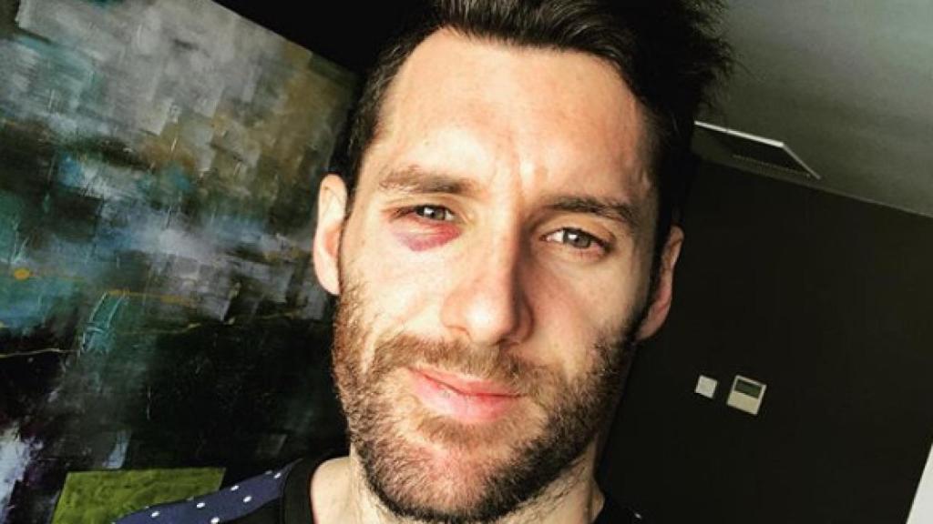 Rudy Fernández tras su golpe ante el Baskonia. Foto: Instagram (@rudy5fernandez)
