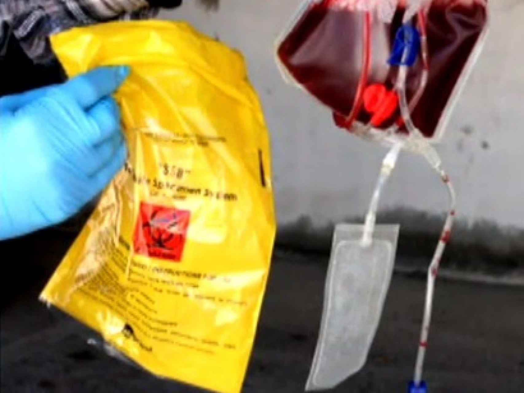Kits de sangre que Raúl no devolvió a su empresa