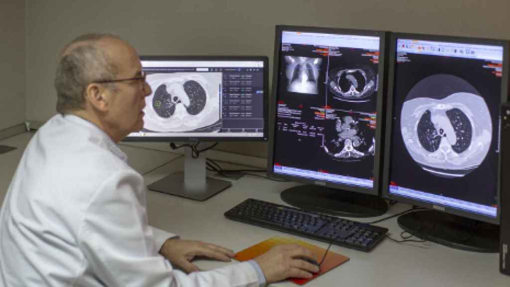 Un médico revisa pruebas de diagnóstico por imagen en cáncer de pulmón.