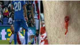 Mario Suárez tendido en el suelo ante el Getafe y la aparatosa herida en su espinilla